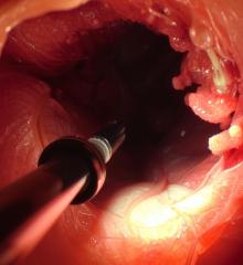 Endoscopy Unit