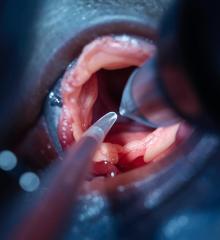 Endoscopy Unit